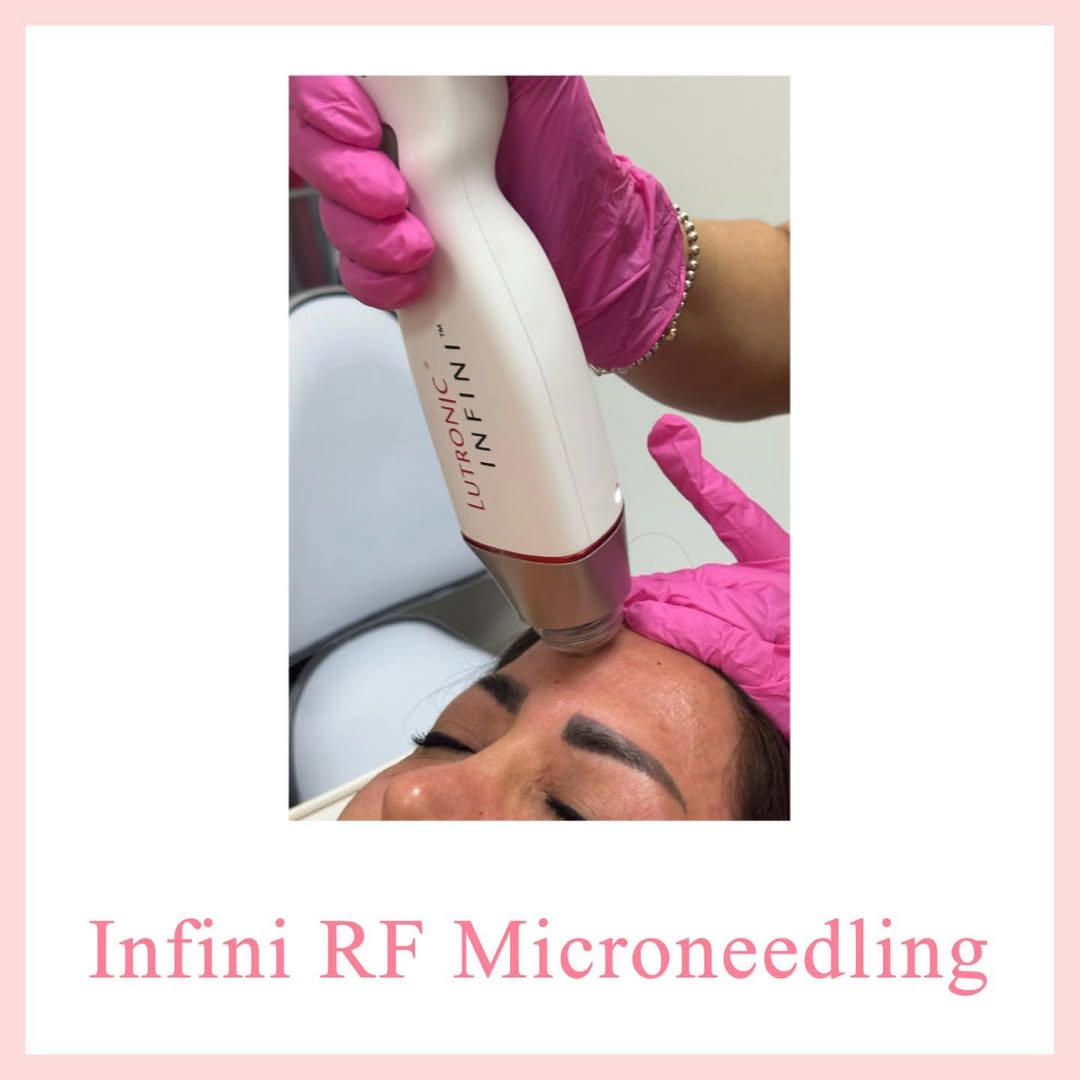 Infini Rf microneedling